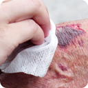 infecciones-camara-hiperbarica